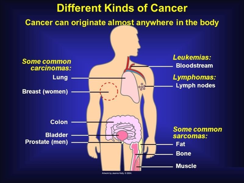 Cancer Services Cancer Services